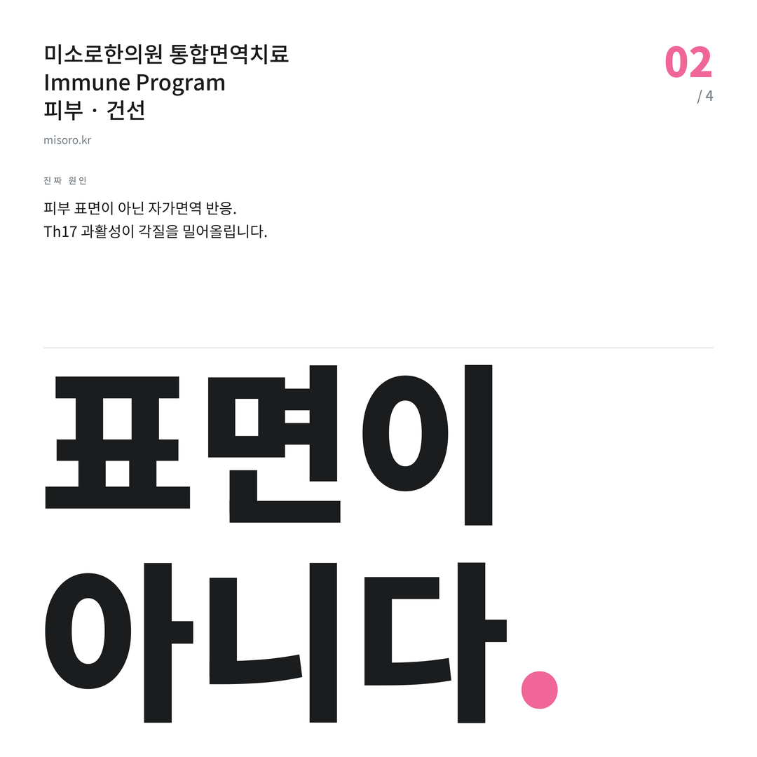 건선 표면이 아니다
