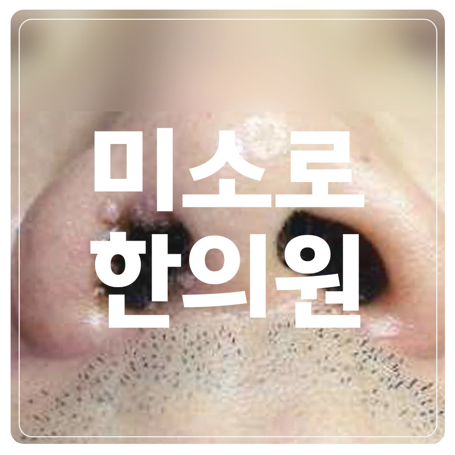 안중 편평사마귀프로폴리스 관련 이미지 1