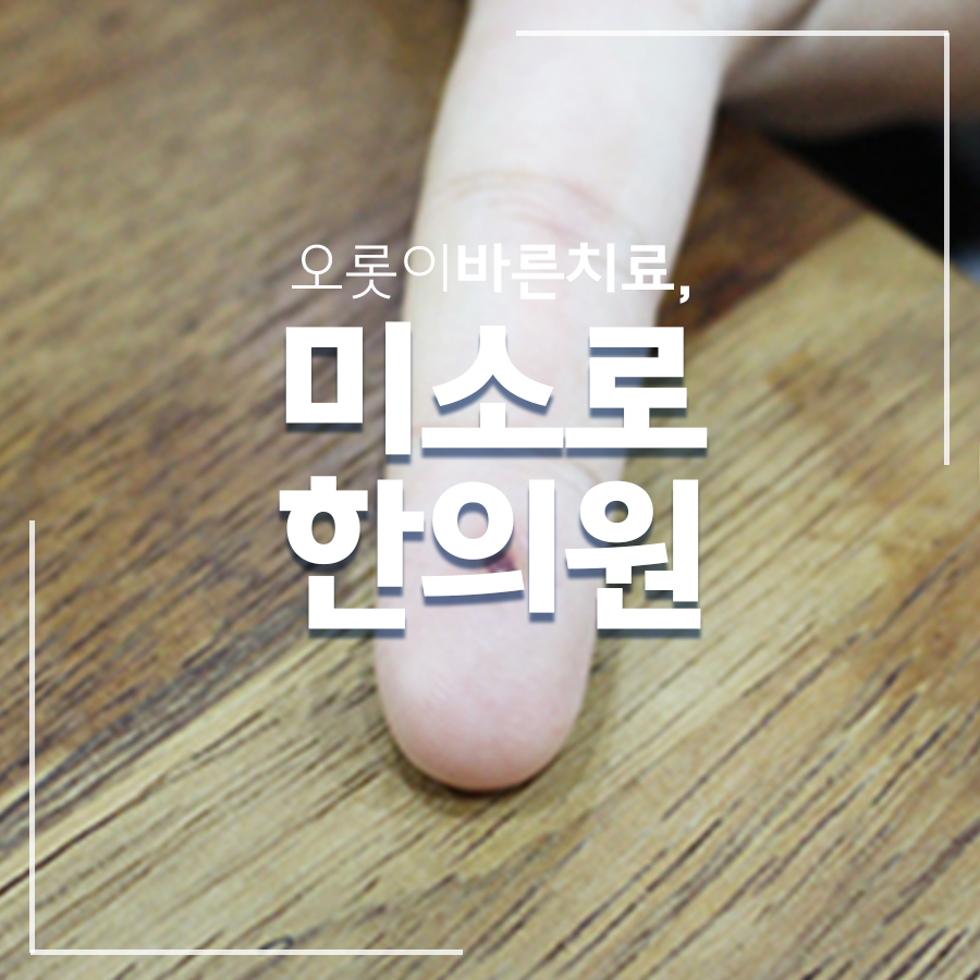 위례 편평사마귀 비용 저렴 관련 이미지 1