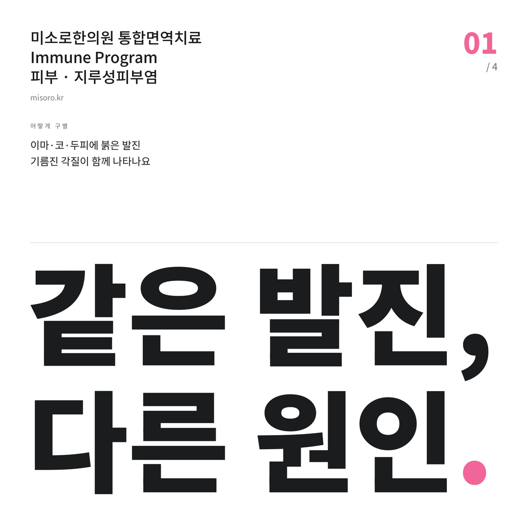 계산동 지루성피부염 같은 발진, 다른 원인