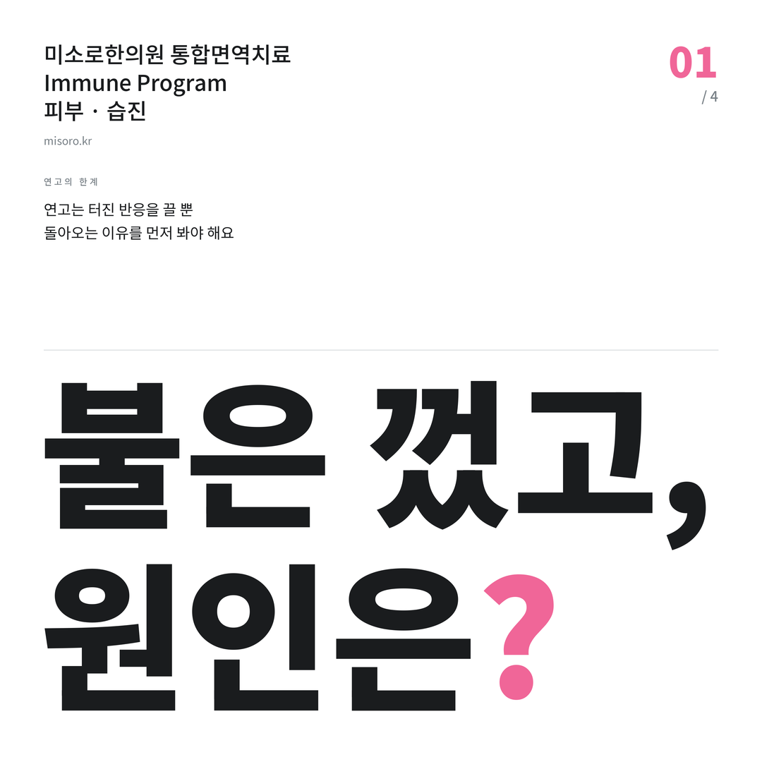 탕정 습진 불은 껐고, 원인은?