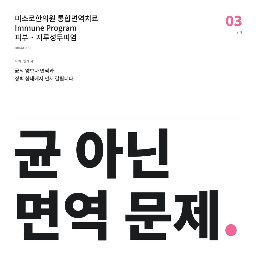 지루성두피염 균 아닌 면역 문제