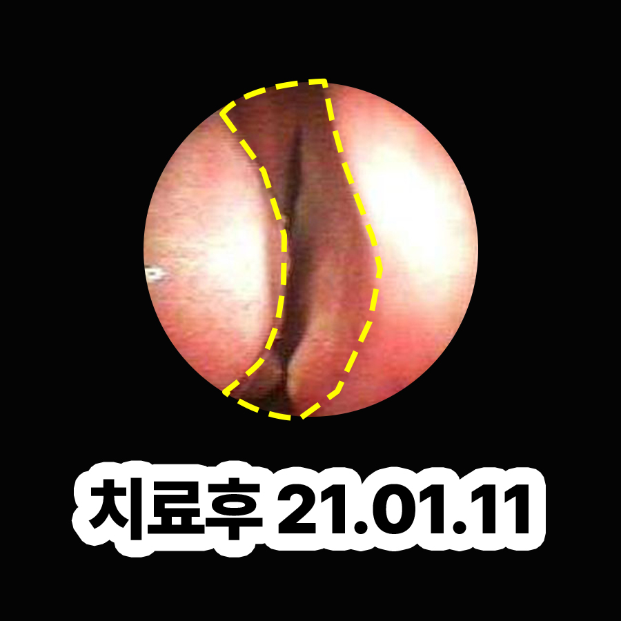 위례 축농증치료한의원 관련 이미지 3