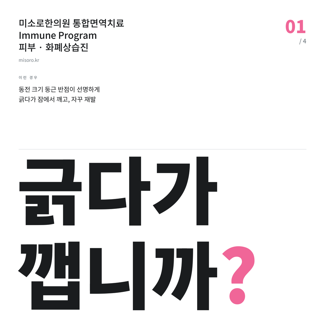 도안동 화폐상습진 긁다가 깹니까?