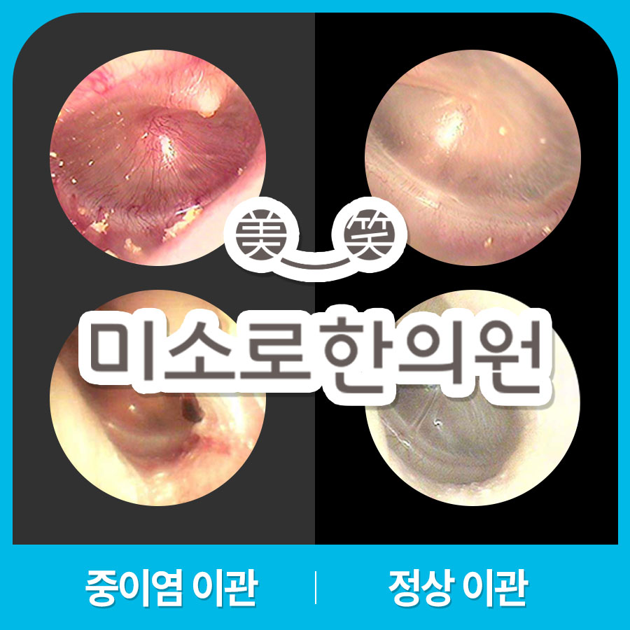 분당 중이염 병원 관련 이미지 1