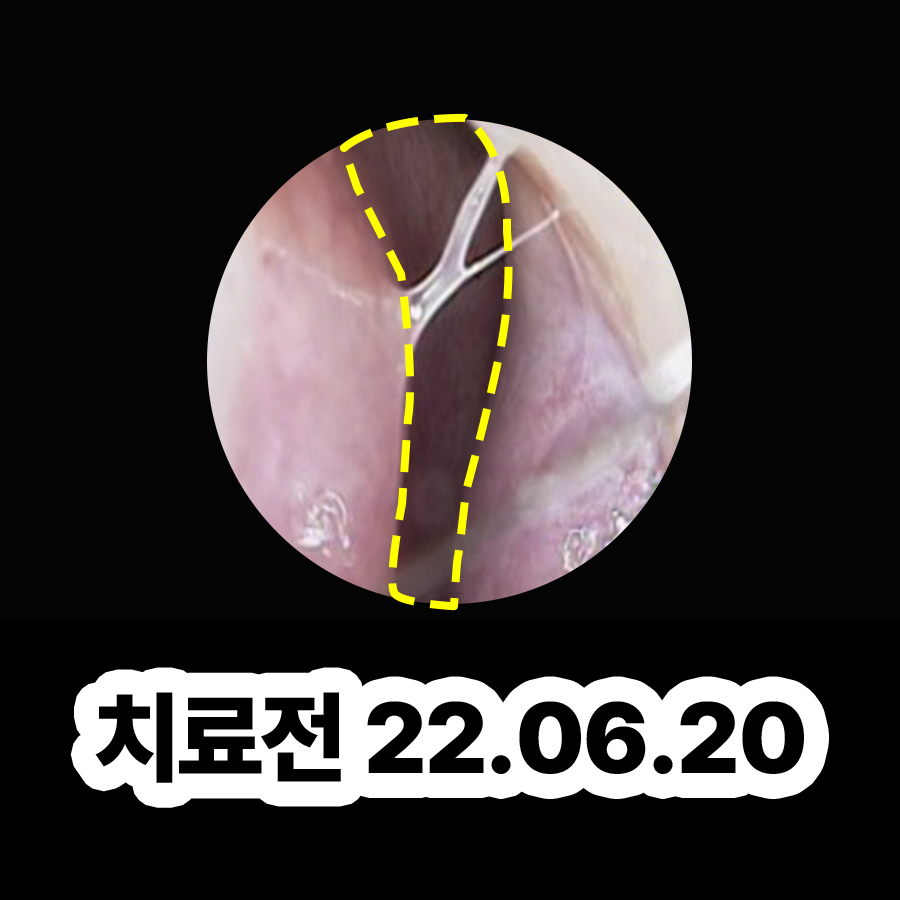 분당 축농증에 좋은 음식 관련 이미지 2