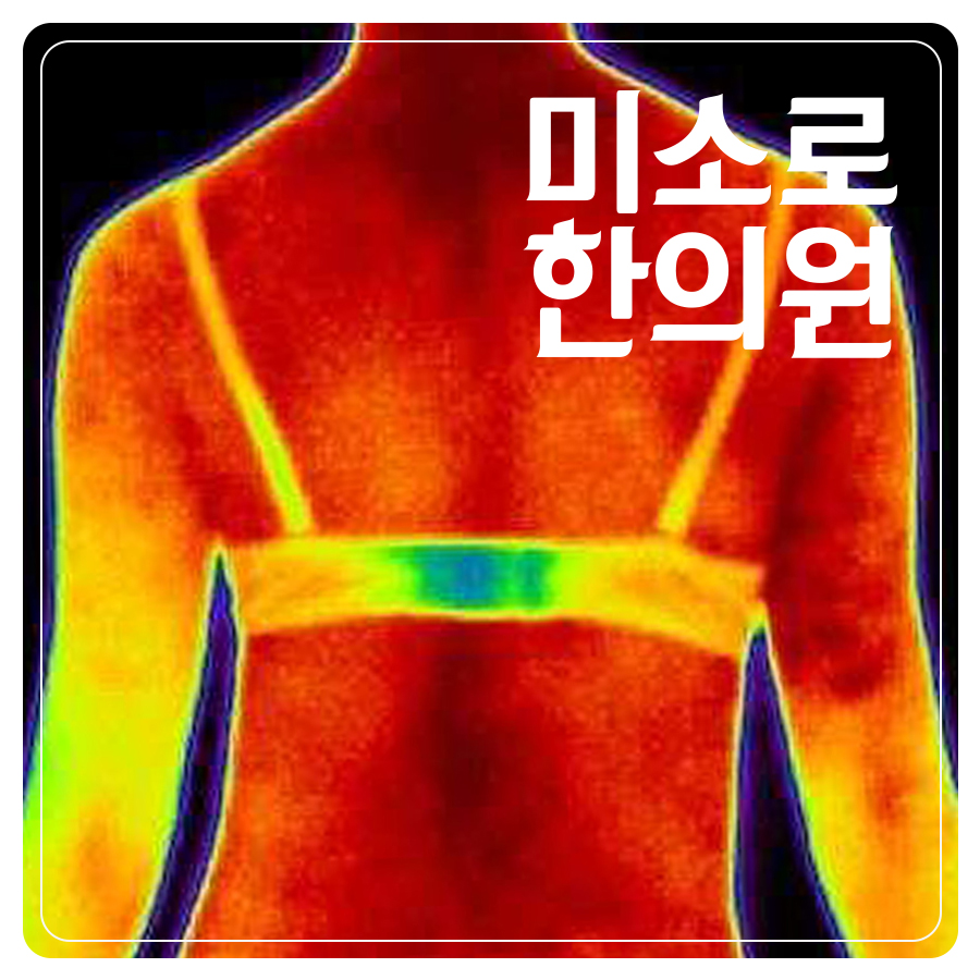 분당 얼굴 다한증 치료 관련 이미지 1