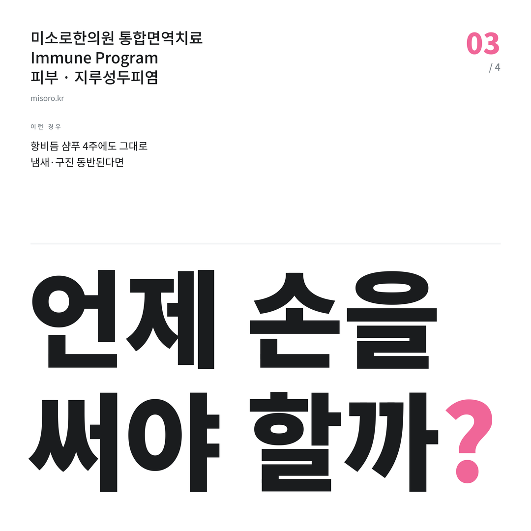 성정동 지루성두피염 언제 손을 써야 할까?