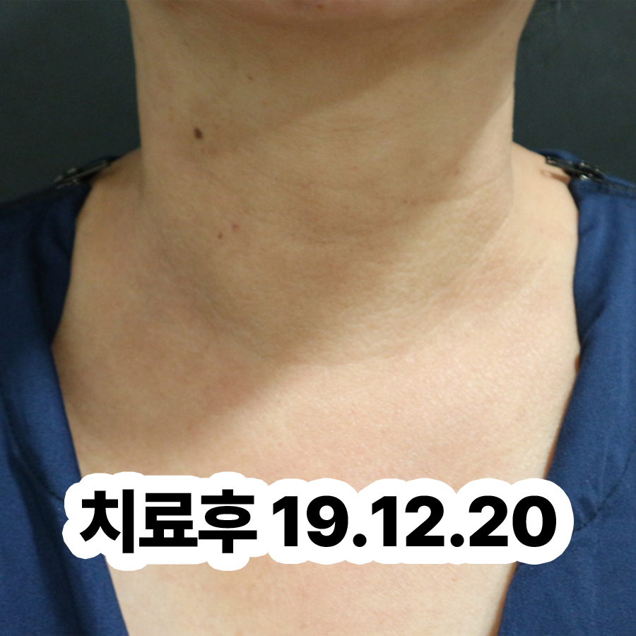 여주 아토피 치료 병원 관련 이미지 3