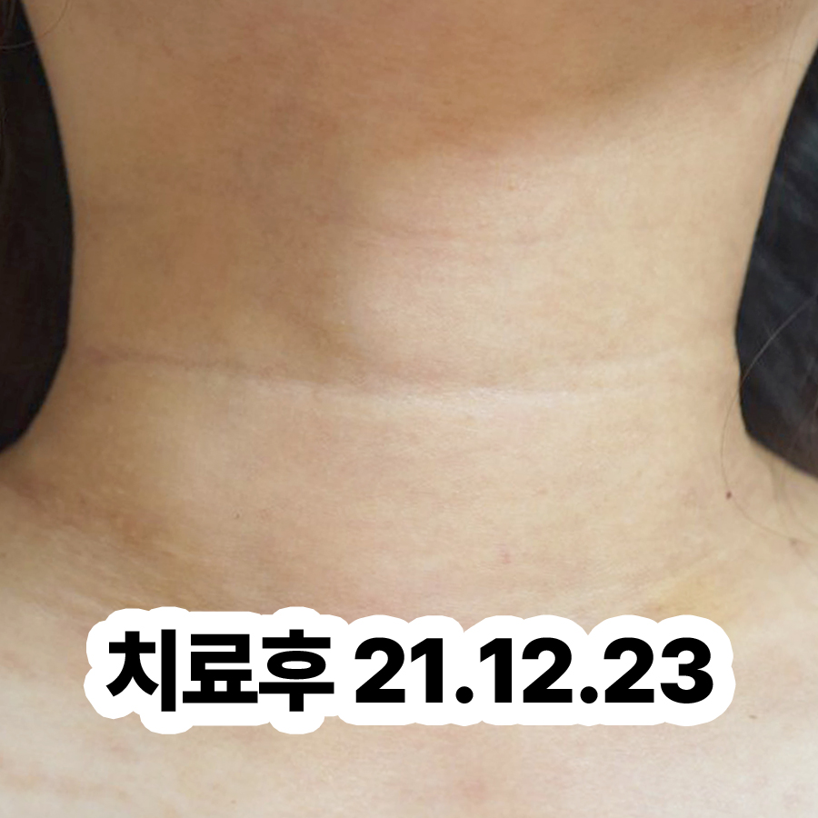 분당 피부 두드러기 병원 어디로 관련 이미지 3