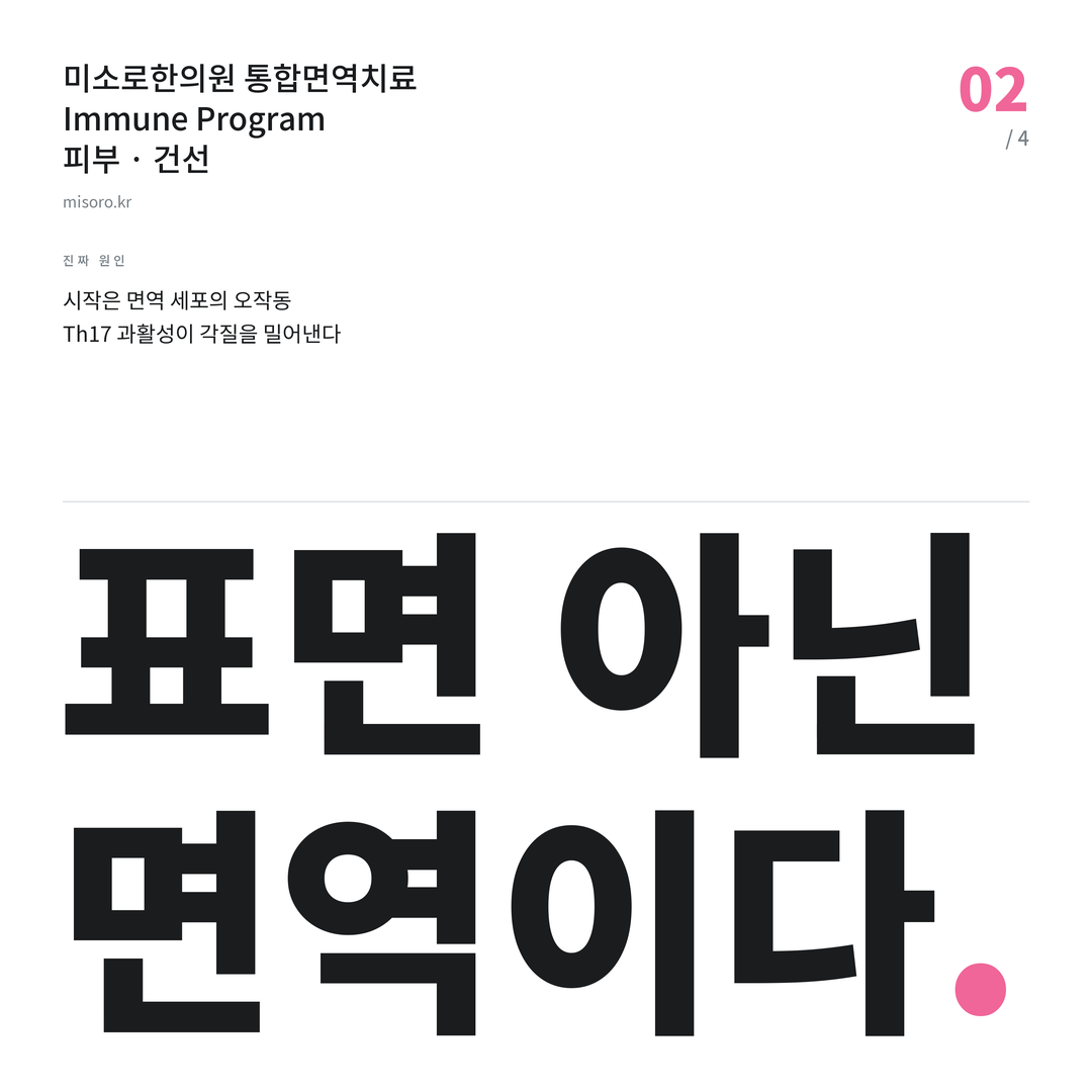 계산동 건선 표면 아닌 면역이다