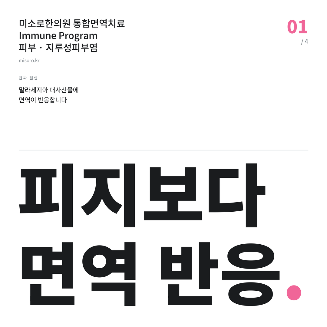 당진 지루성피부염 피지보다 면역 반응