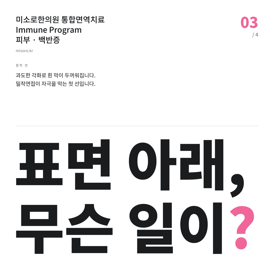 백반증 표면 아래, 무슨 일이?