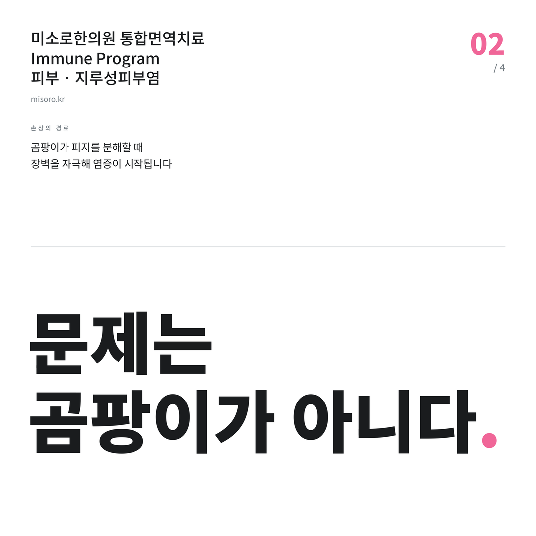 오산 지루성피부염 문제는 곰팡이가 아니다