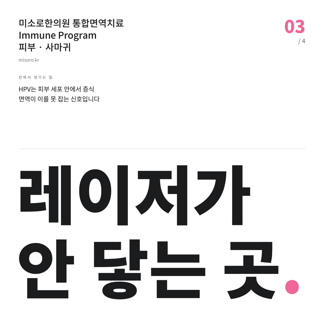 사마귀 레이저가 안 닿는 곳