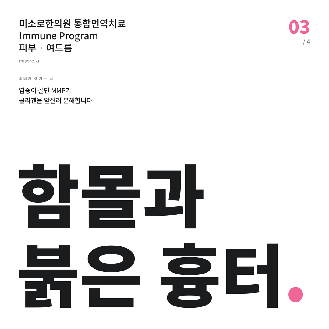 성정동 여드름 함몰과 붉은 흉터