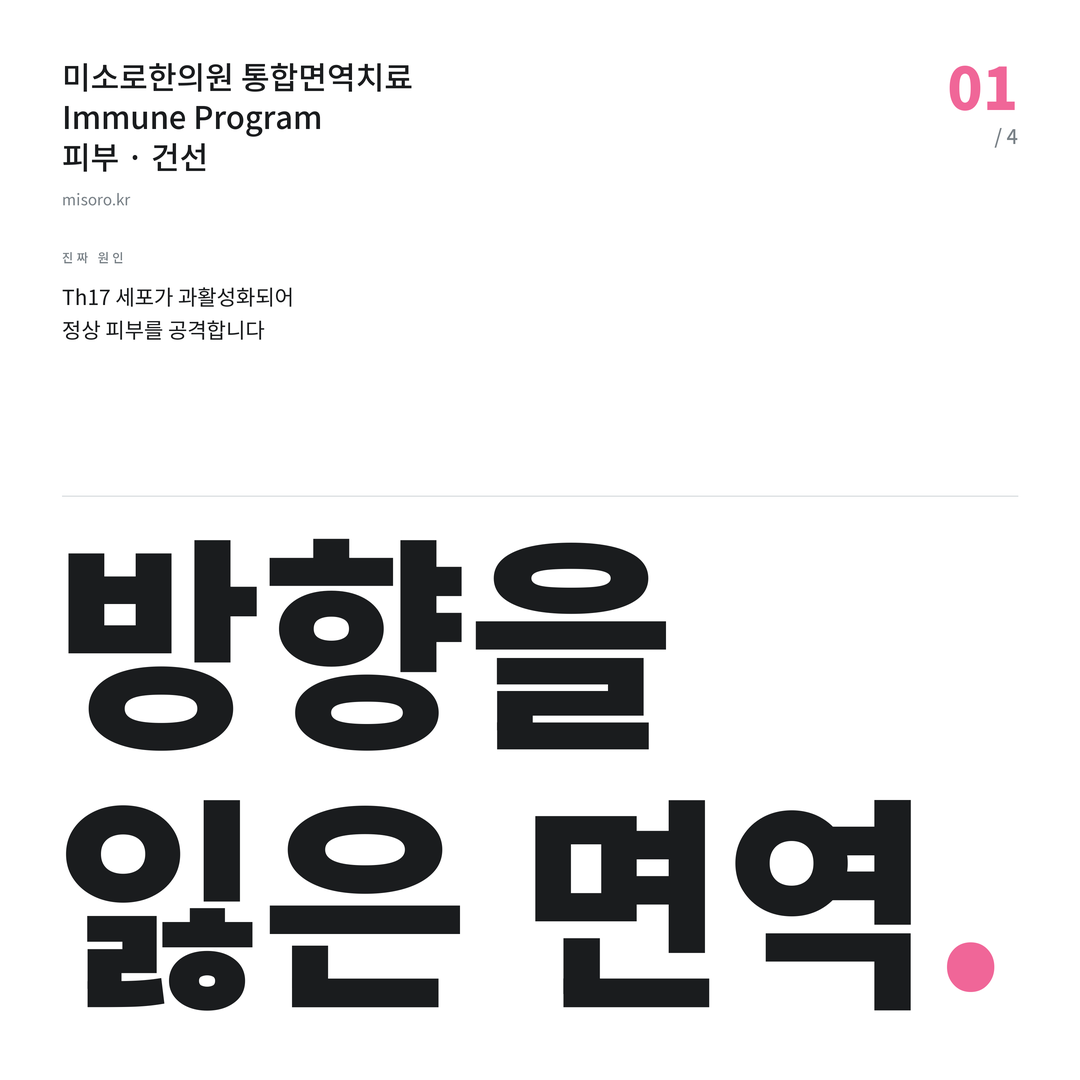 고잔동 건선 방향을 잃은 면역