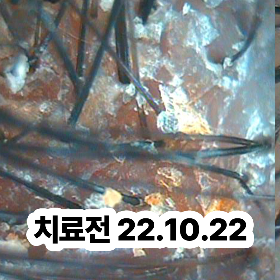 성남 머리 지루성 피부염 연고 관련 이미지 2