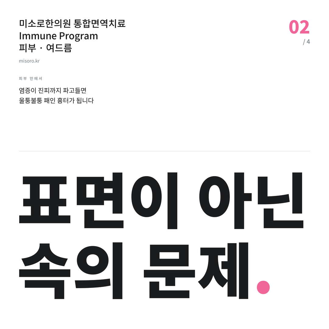 송도 여드름 표면이 아닌 속의 문제