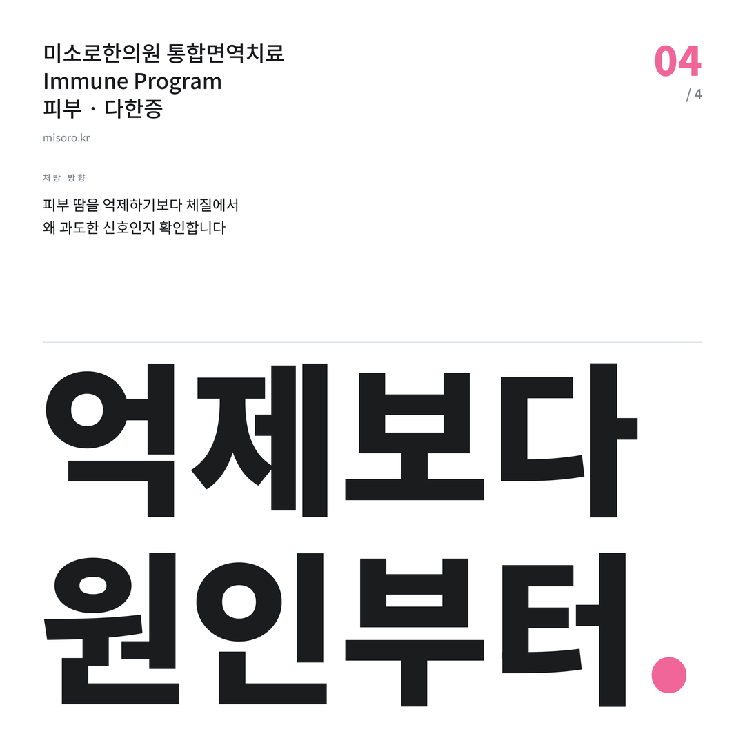 소사벌 다한증 억제보다 원인부터