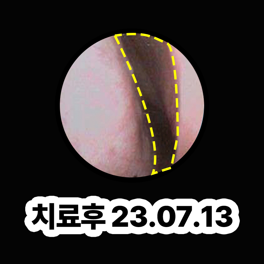 분당 축농증 이비인후과 관련 이미지 3