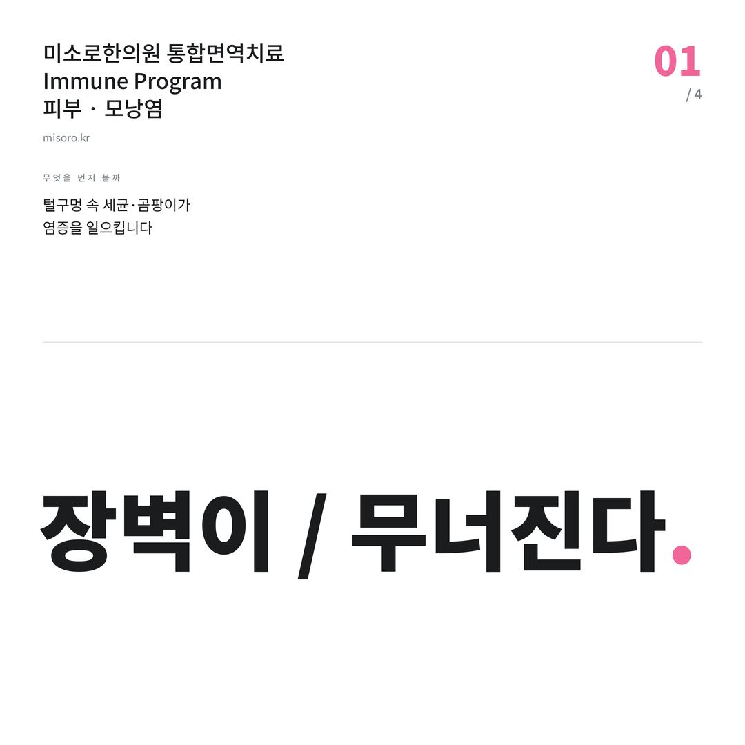 문래 모낭염 장벽이 / 무너진다