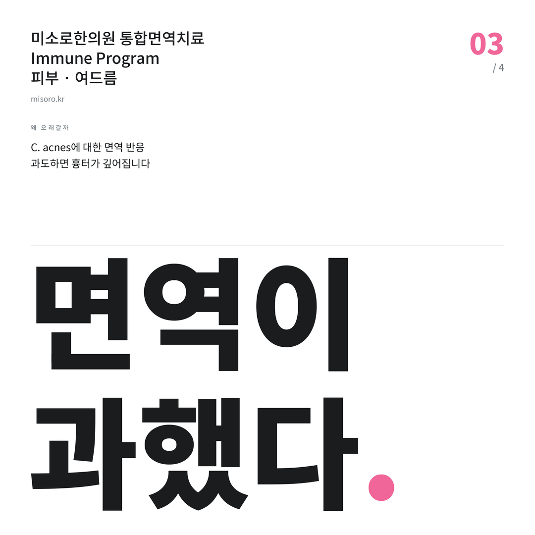 등촌동 여드름 면역이 과했다