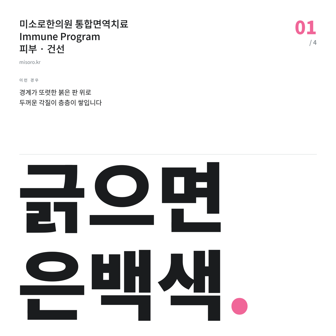 대전 건선 긁으면 은백색