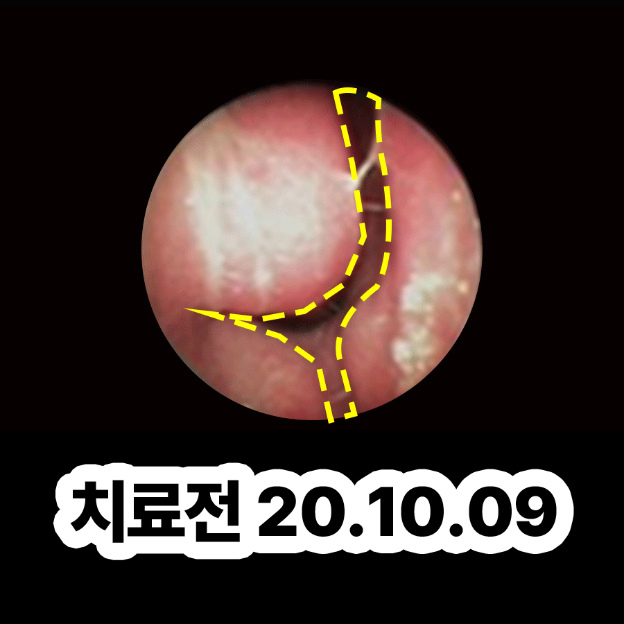 분당 축농증치료한의원 관련 이미지 2