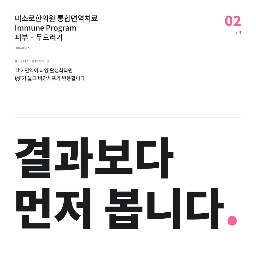두드러기 결과보다 먼저 봅니다