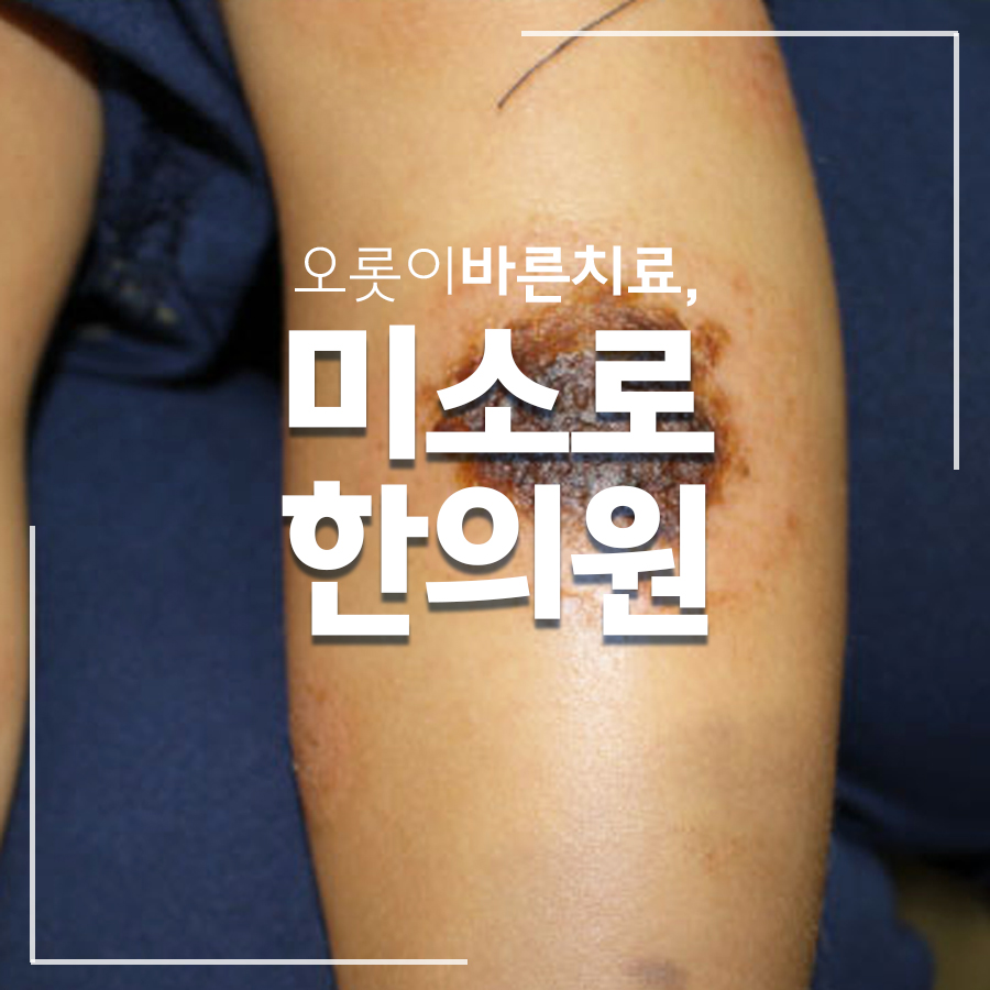 여주 고환 습진 병원 관련 이미지 1