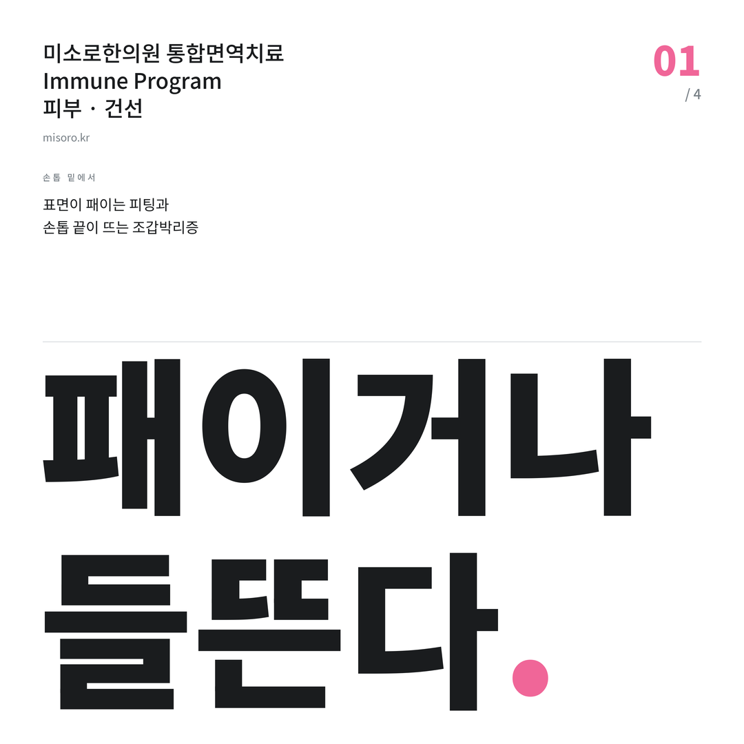 소사벌 건선 패이거나 들뜬다
