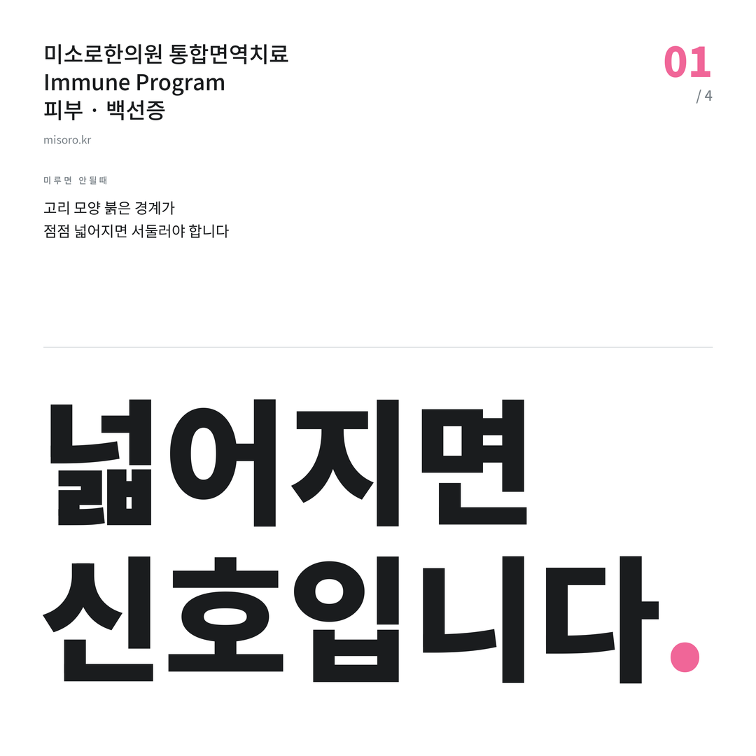 죽전 백선증 넓어지면 신호입니다