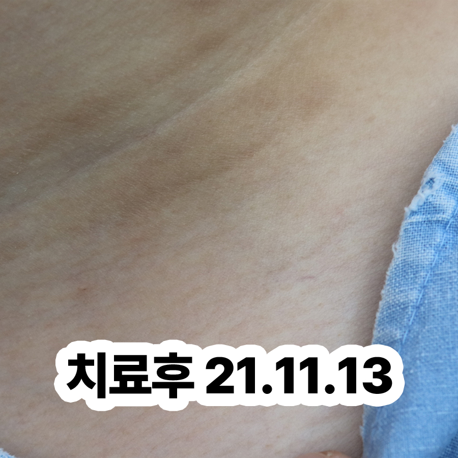경기광주 지루성피부염 병원 추천 관련 이미지 3