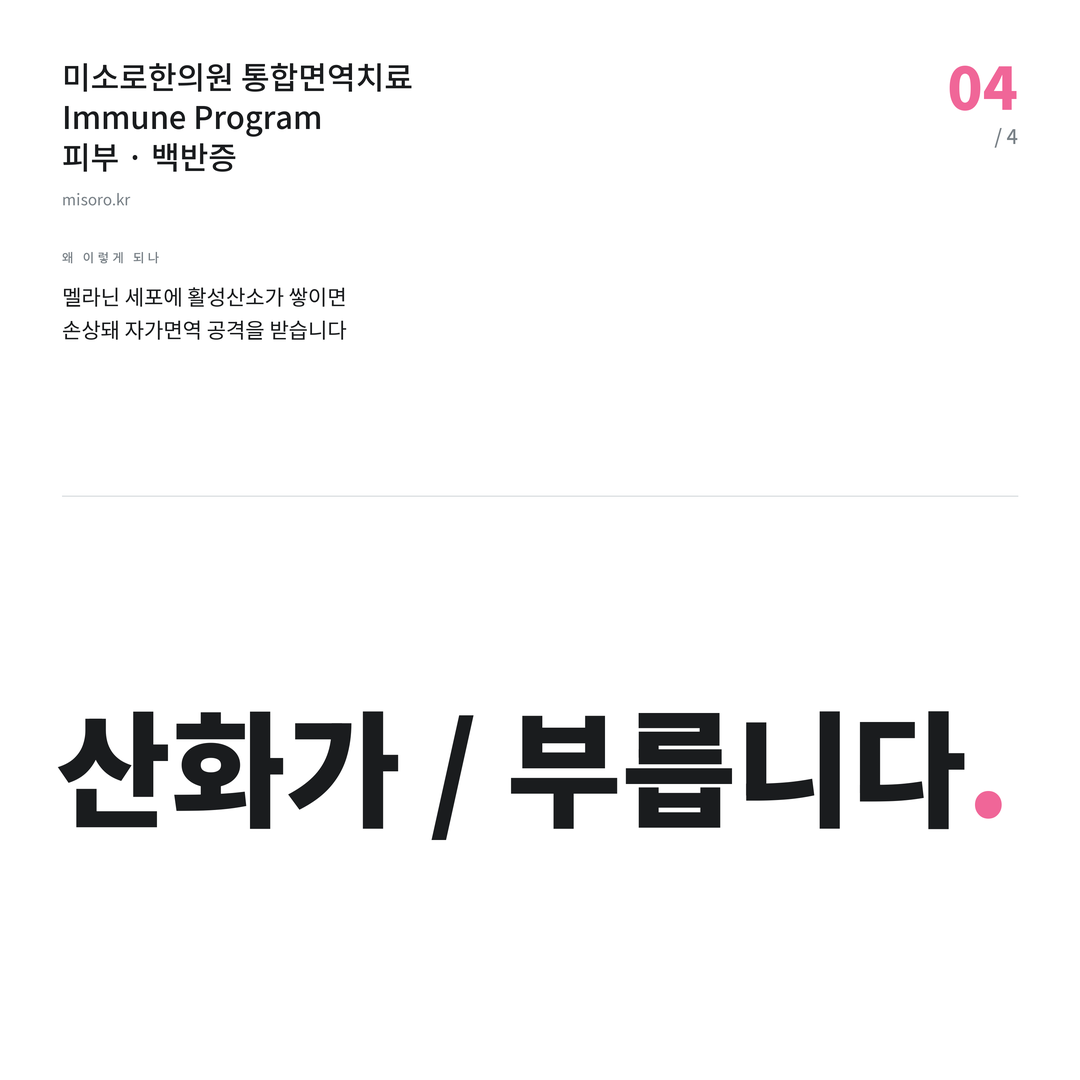 백반증 산화가 / 부릅니다