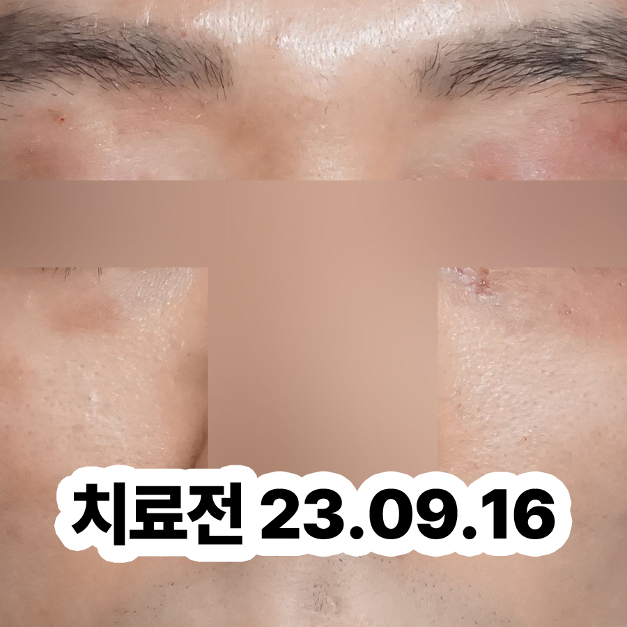 위례 아토피치료한의원 관련 이미지 2
