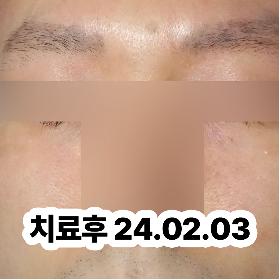 위례 아토피치료한의원 관련 이미지 3