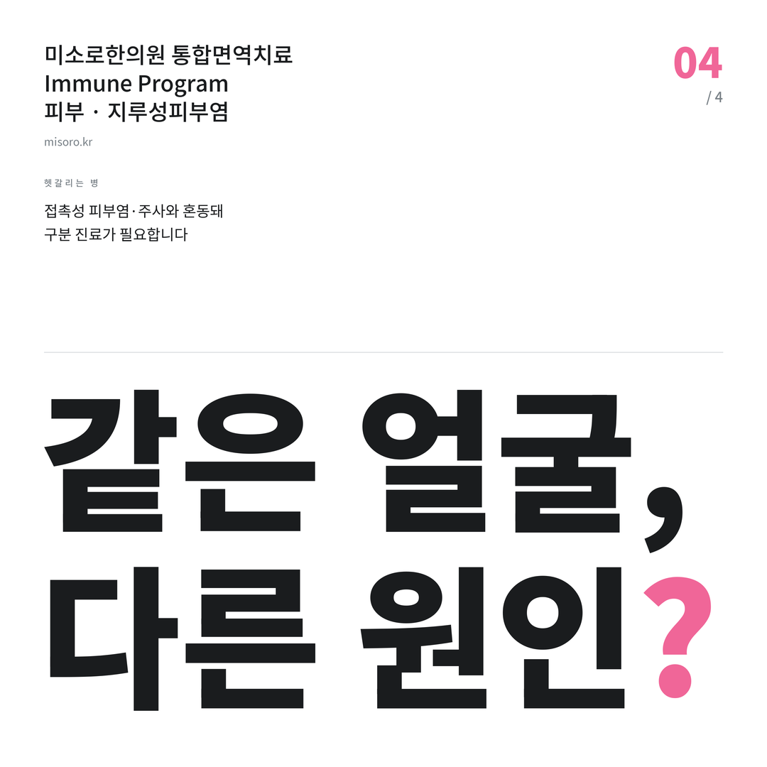 영등포 지루성피부염 같은 얼굴, 다른 원인?