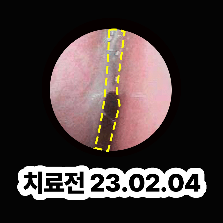 분당 축농증 이비인후과 관련 이미지 2