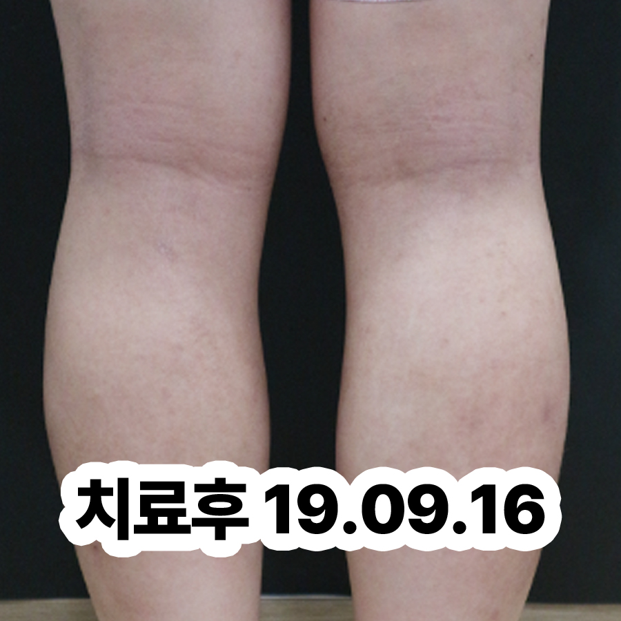 분당 아토피 한의원 관련 이미지 3