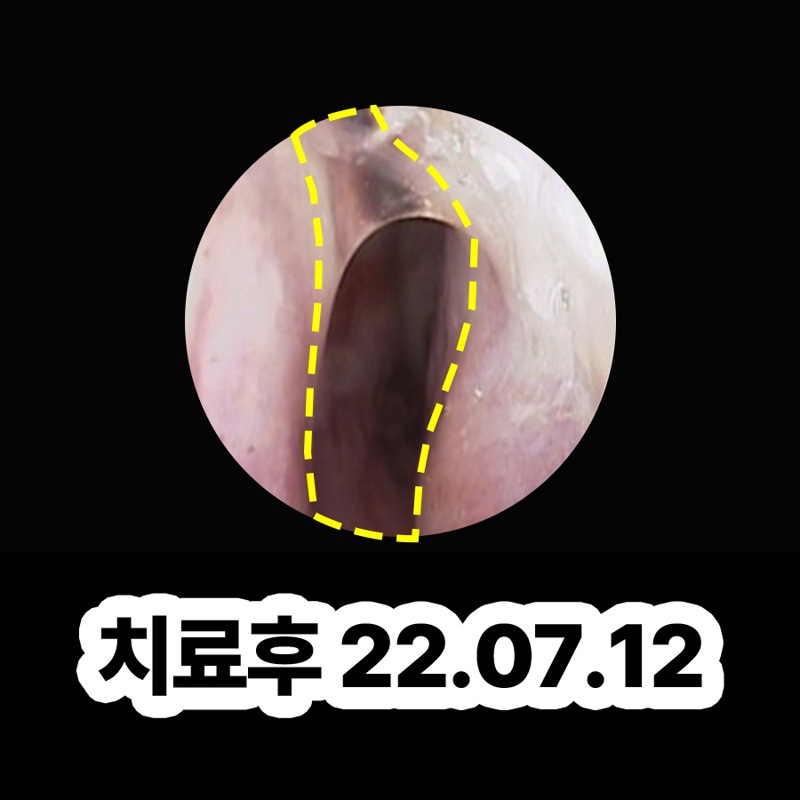 분당 축농증에 좋은 음식 관련 이미지 3