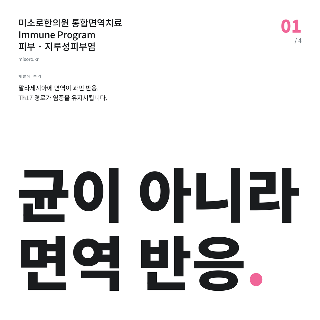 지루성피부염 균이 아니라 면역 반응