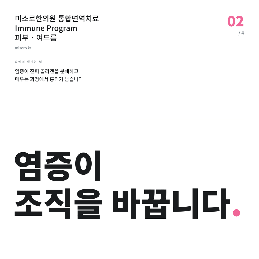 여드름 염증이 조직을 바꿉니다