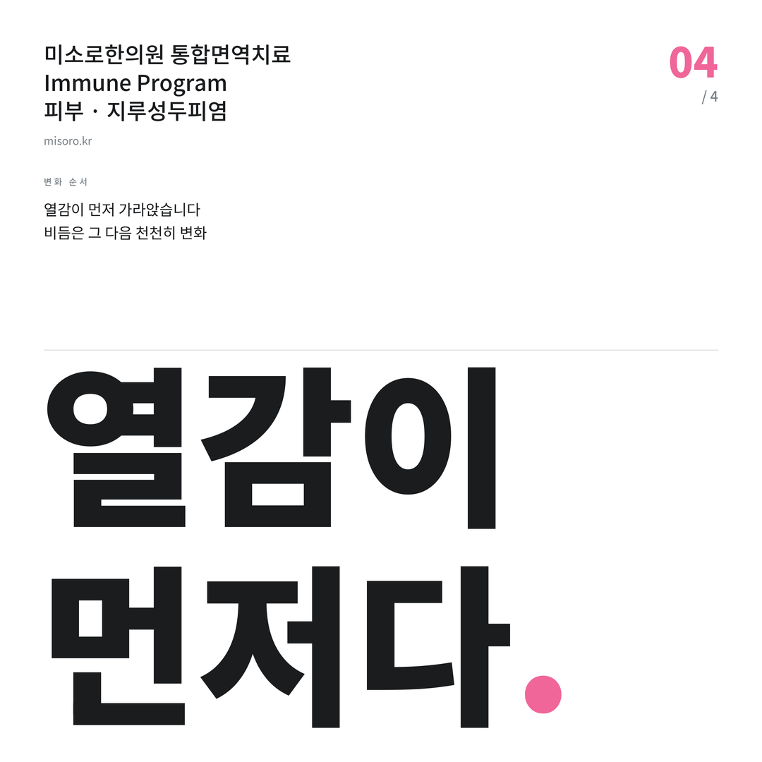 수원 지루성두피염 열감이 먼저다