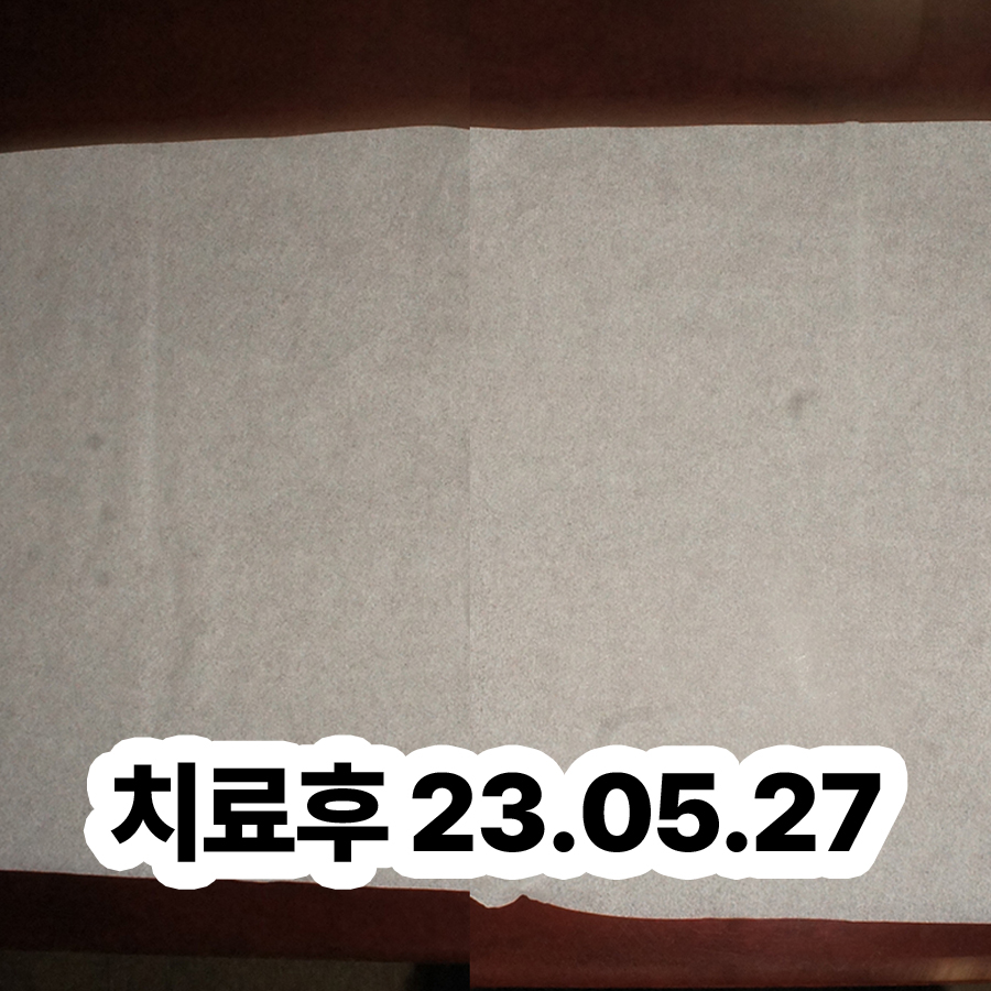 분당 수족다한증병원 관련 이미지 3