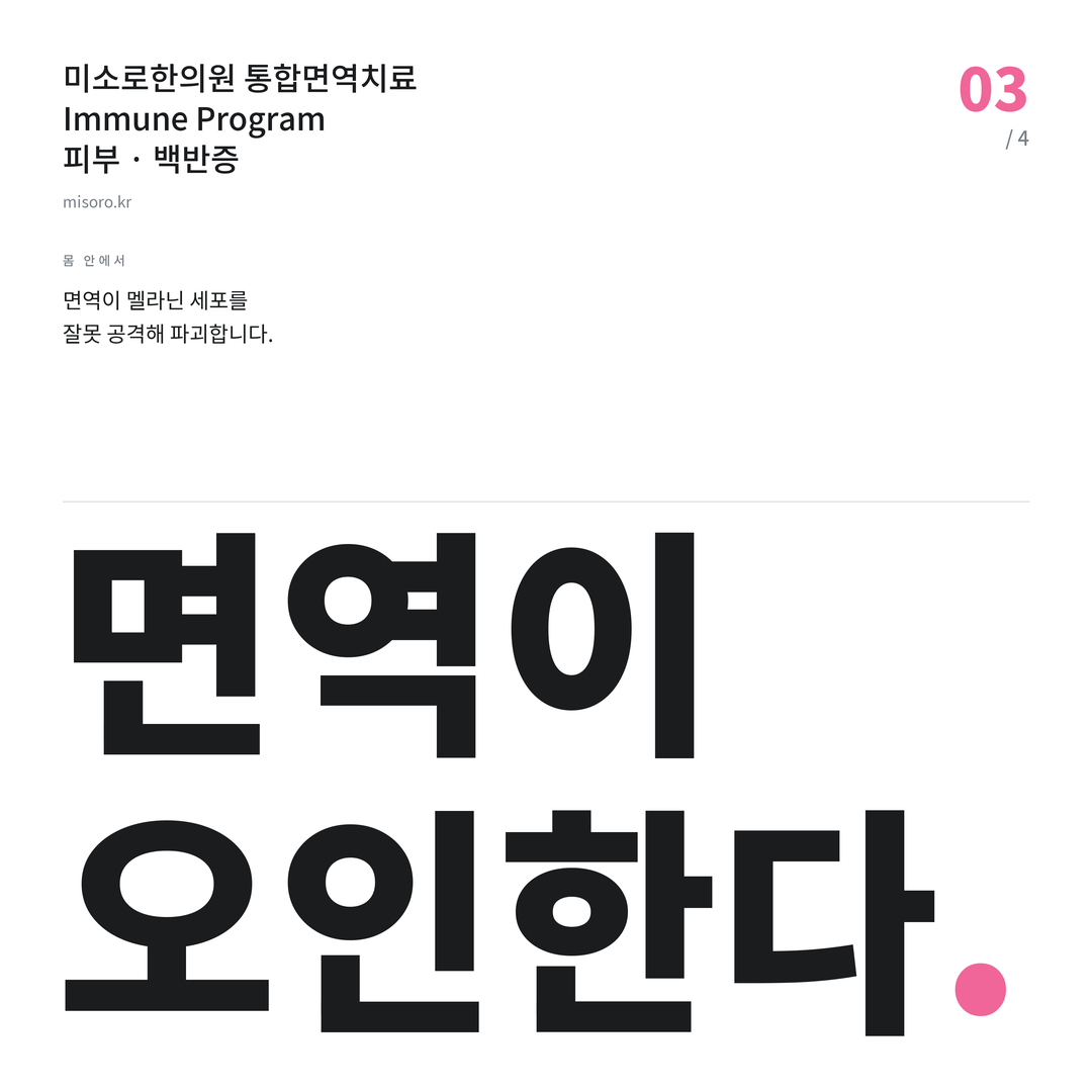 효자동 백반증 면역이 오인한다
