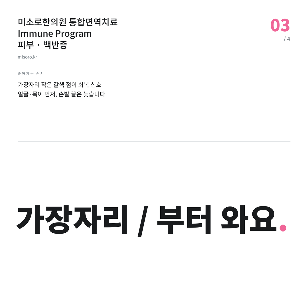 백반증 가장자리 / 부터 와요