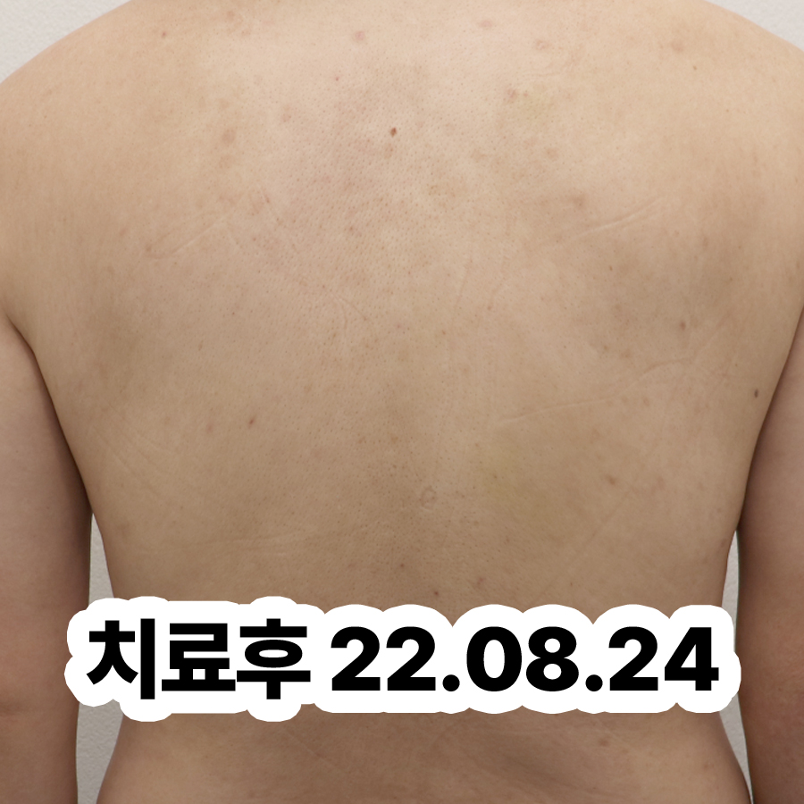 분당 두드러기한약 관련 이미지 3