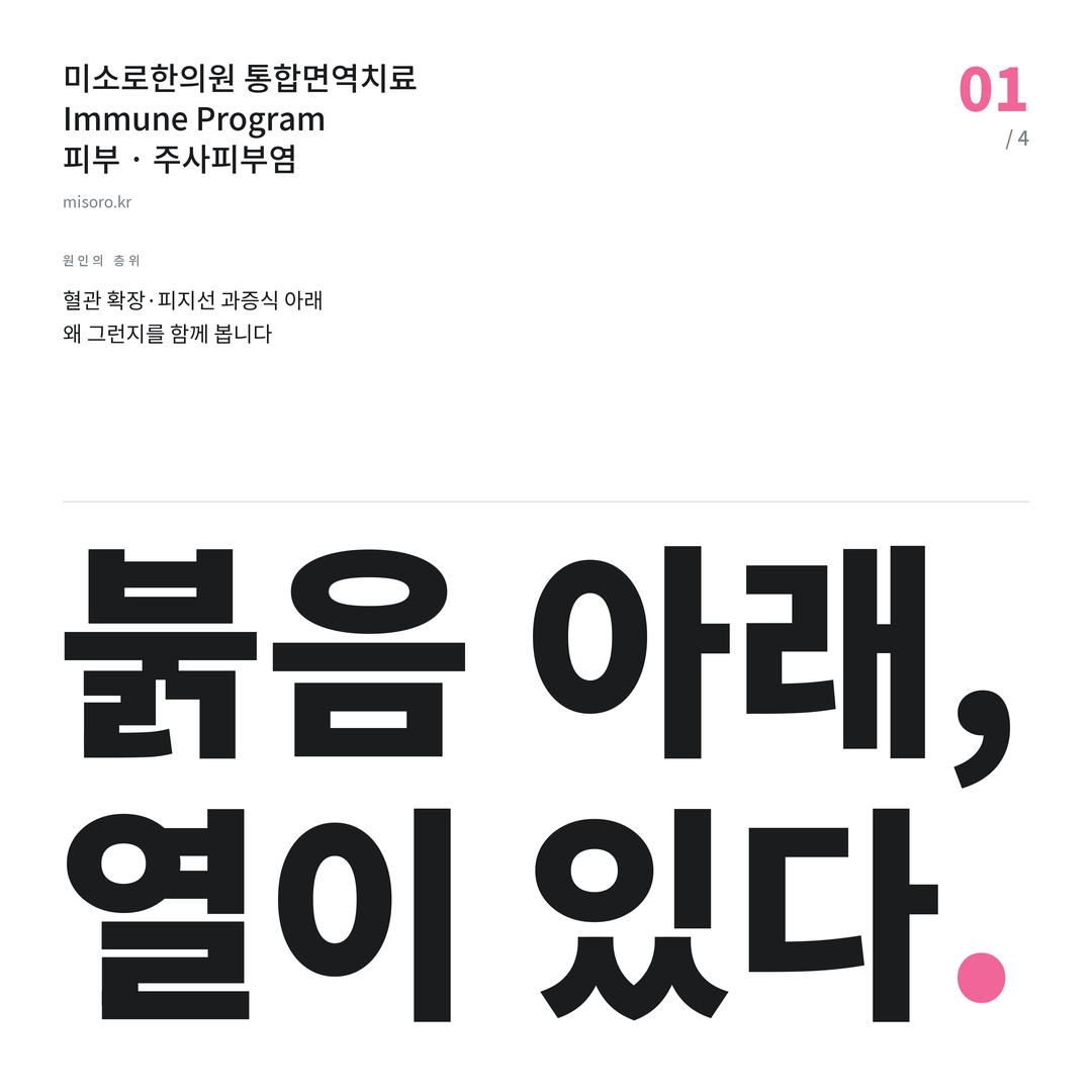 배곧 주사피부염 붉음 아래, 열이 있다
