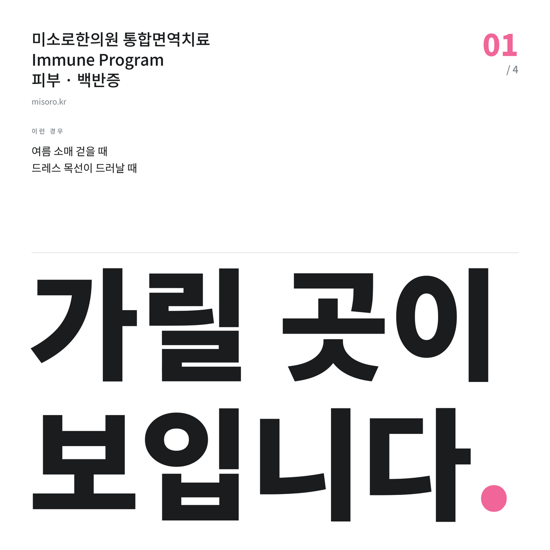 서정리 백반증 가릴 곳이 보입니다